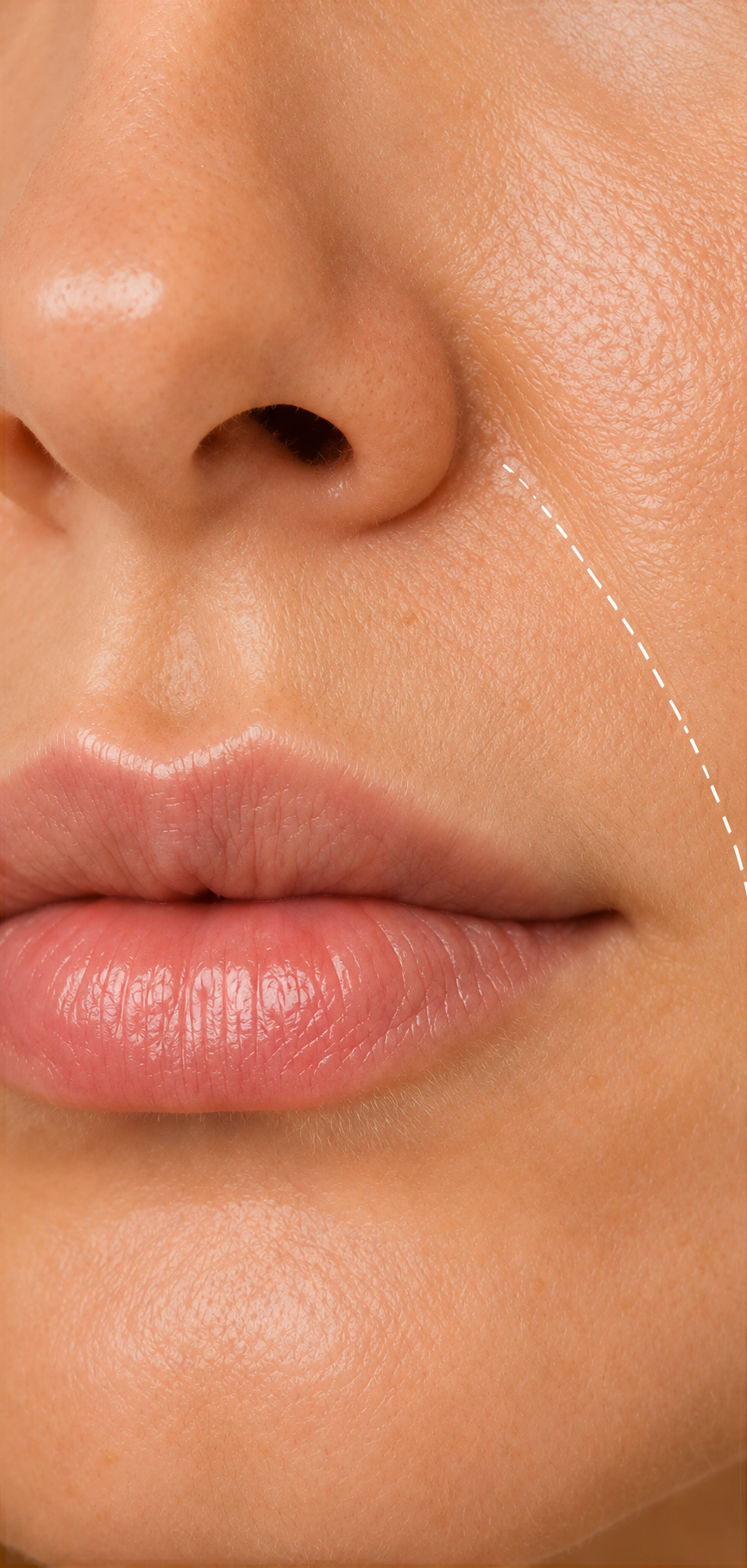 neus en lippen plooien
